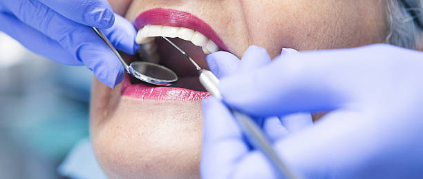 Best Cracked Tooth Emergency Dentist  in Airy Heights, WA